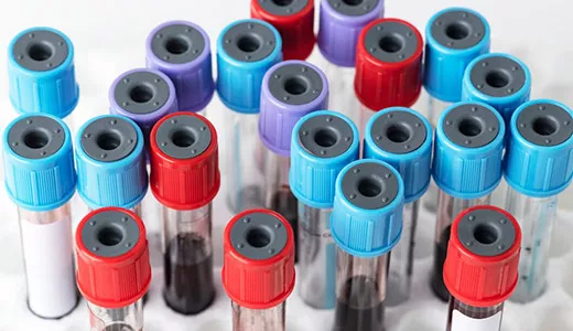 Hematology Reagent